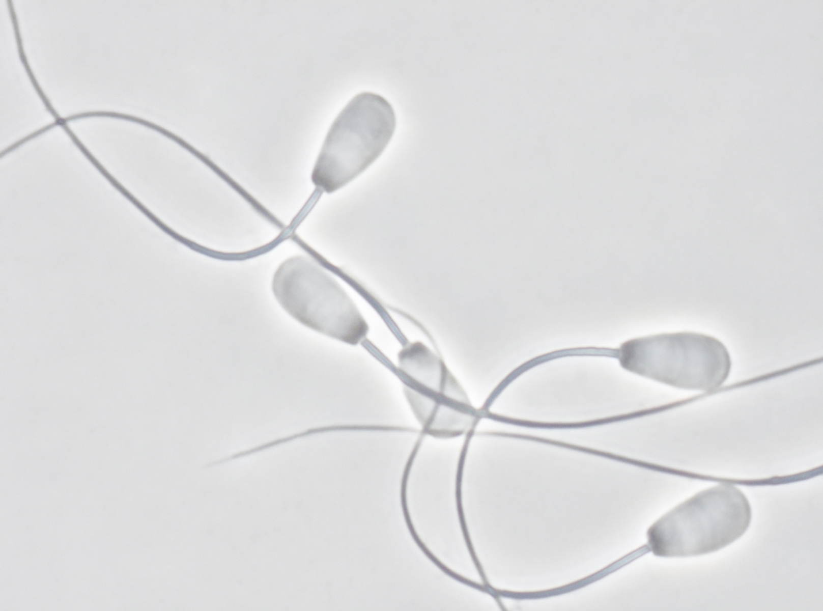 http://www.olivierlovey.ch/files/gimgs/th-23_63_spermatozoides-de-baron-2.jpg